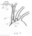 Fig. 08 - Dual endovascular filter and methods of use