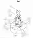 Fig. 02 - Wound closing device