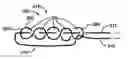 Fig. 01 - Methods and devices for repairing and anchoring damaged tissue