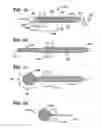 Fig. 02 - Methods and devices for repairing and anchoring damaged tissue