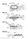 Fig. 06 - Methods and devices for repairing and anchoring damaged tissue
