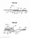 Fig. 07 - Methods and devices for repairing and anchoring damaged tissue