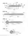 Fig. 02 - Methods and devices for repairing meniscal tissue