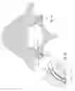Fig. 02 - Systems and methods for facet joint treatment