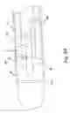 Fig. 12 - Systems and methods for facet joint treatment