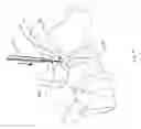 Fig. 15 - Systems and methods for facet joint treatment