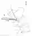 Fig. 16 - Systems and methods for facet joint treatment