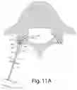 Fig. 19 - Systems and methods for facet joint treatment