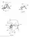 Fig. 37 - Systems and methods for facet joint treatment