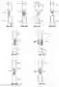 Fig. 05 - Vertebral rods and methods of use