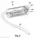 Fig. 07 - Multi-port modular connector for implantable electrical stimulation systems and methods of making and using
