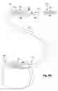 Fig. 04 - Systems and methods for anchoring leads of electrical stimulation systems in and around bony structures