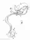 Fig. 02 - Methods and apparatus for detecting ventricular depolarizations during atrial pacing