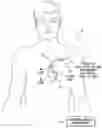 Fig. 01 - Systems and methods for optimizing ventricular pacing delays for use with multi-pole leads