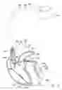 Fig. 09 - Systems and methods for optimizing ventricular pacing delays for use with multi-pole leads