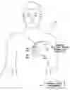 Fig. 01 - Systems and methods for optimizing ventricular pacing delays during atrial fibrillation