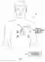 Fig. 02 - Systems and methods for optimizing ventricular pacing delays during atrial fibrillation