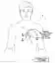 Fig. 01 - Systems and methods for determining ventricular pacing sites for use with multi-pole leads