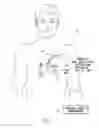 Fig. 02 - Systems and methods for determining ventricular pacing sites for use with multi-pole leads