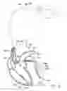 Fig. 09 - Systems and methods for determining ventricular pacing sites for use with multi-pole leads
