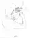 Fig. 03 - TOPICAL ANESTHESIA INDUCING APPARATUS FOR INDUCING TOPICAL ANESTHESIA AND TOPICAL ANESTHESIA INDUCING APPLICATORS AND TOPICAL ANESTHESIA INDUCING ELECTRODES THEREFORE