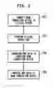 Fig. 07 - Bone conduction device fitting