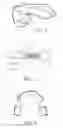 Fig. 02 - Trigeminal Nerve Stimulation Systems and Methods of Use