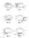 Fig. 09 - Method for providing directional therapy to skeletal joints