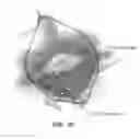Fig. 27 - Method for providing directional therapy to skeletal joints