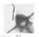 Fig. 32 - Method for providing directional therapy to skeletal joints