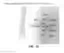Fig. 35 - Method for providing directional therapy to skeletal joints