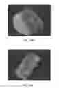 Fig. 47 - Method for providing directional therapy to skeletal joints