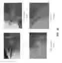 Fig. 49 - Method for providing directional therapy to skeletal joints