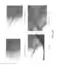 Fig. 56 - Method for providing directional therapy to skeletal joints