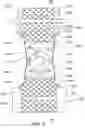 Fig. 08 - COOLING GARMENT
