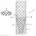Fig. 01 - STENT