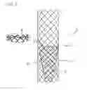 Fig. 04 - STENT