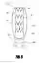 Fig. 07 - Stent graft