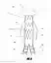 Fig. 08 - Stent graft