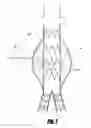 Fig. 09 - Stent graft