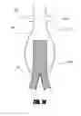 Fig. 16 - Stent graft