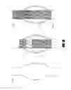 Fig. 20 - Stent graft