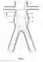 Fig. 02 - Endoluminal prosthetic conduit systems and method of coupling