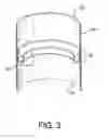 Fig. 04 - Endoluminal prosthetic conduit systems and method of coupling