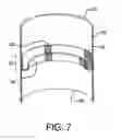 Fig. 08 - Endoluminal prosthetic conduit systems and method of coupling