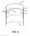 Fig. 09 - Endoluminal prosthetic conduit systems and method of coupling