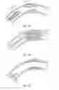 Fig. 02 - Bioerodible Medical Implants