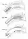 Fig. 02 - ENDOPROSTHESES