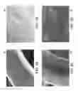 Fig. 06 - ENDOPROSTHESES