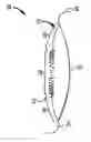 Fig. 01 - Truncated diffractive intraocular lenses